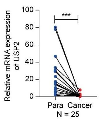 The expression of ubiquitin-specific peptidase 2 was low in clear cell renal cell carcinoma tissues.jpg